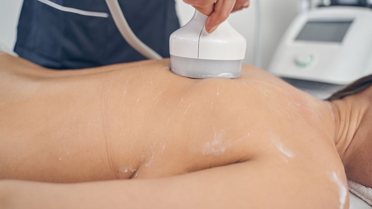 Body Contouring
