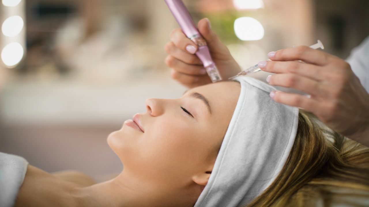 Micro-Needling
